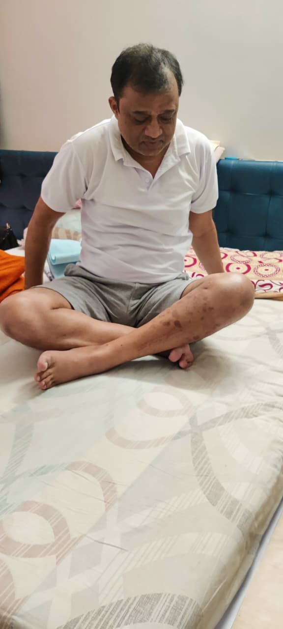 Post-Treatment Recovery