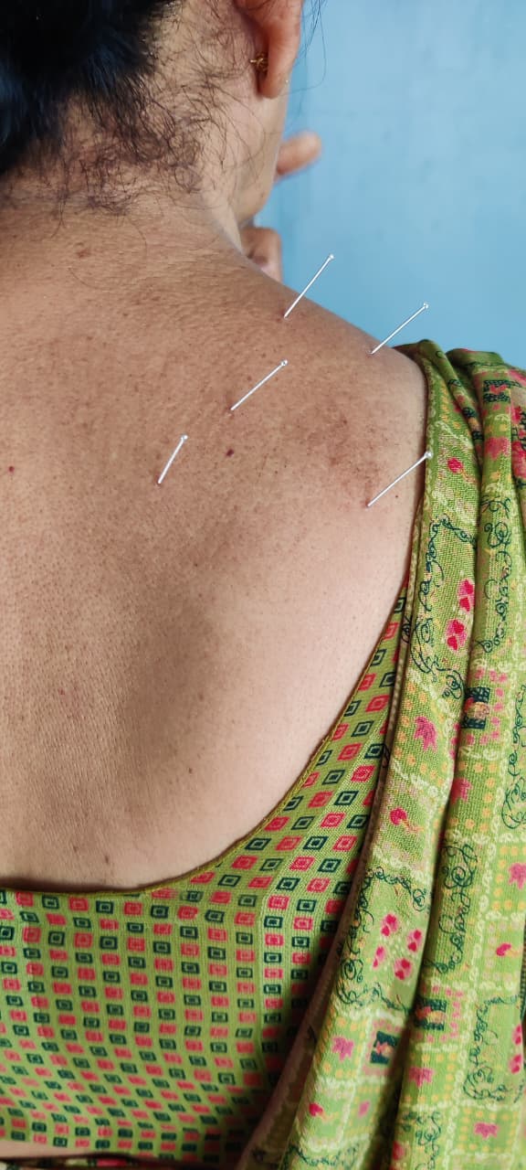 Neck and Shoulder Treatment